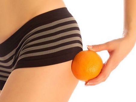 Антицеллюлитный массаж (бедра,живот,зона галифе)