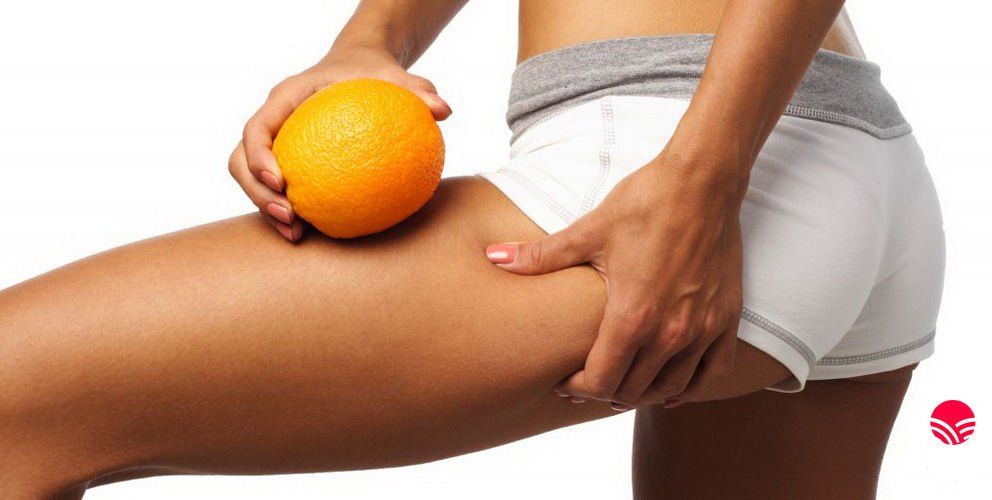 Антицеллюлитный массаж